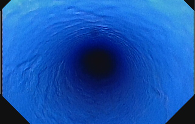 排水管施工イメージ3